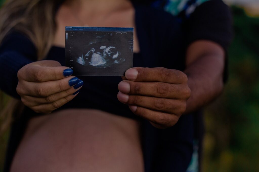 Ultrassom obstétrico realizado durante pré-natal